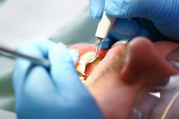 Best Pediatric Emergency Dentist in Pleasant Hill, MS